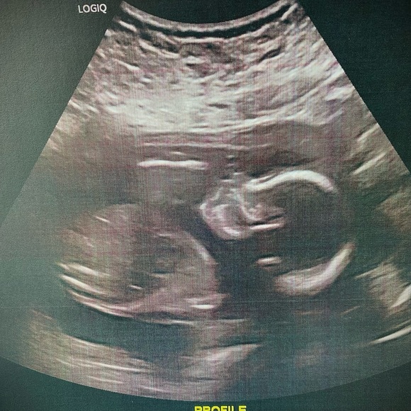 Posh Ambassador Emma Charles🤎 - Picture 7 of 10